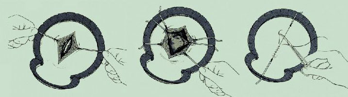 1585805985398700.jpg 153304_1.jpg